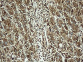 PPT1 / CLN1 Antibody (clone OTI1F10)