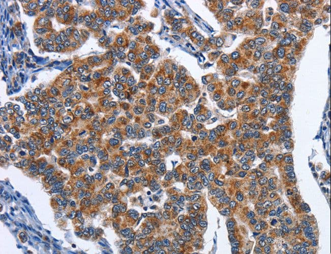 NECL-1 / CADM3 Antibody