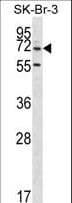 ZNF398 Antibody (aa186-215)