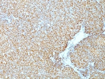 CCND1 / Cyclin D1 Antibody (clone CCND1/809)