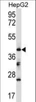 BCKDK Antibody (aa159-188)