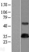 TRAT1 / TRIM Protein (Over-Expression Lysate Myc-DDK (Flag))