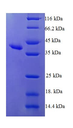 Human HRSP12 / UK114 Protein (Recombinant GST)