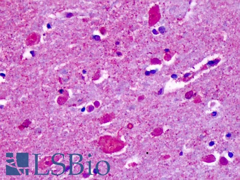 IHC-plus™ CELSR2 Antibody (N-Terminus)
