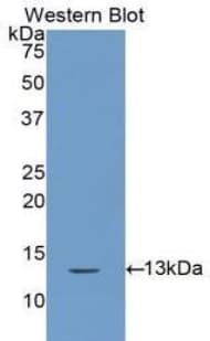 CSTA / Cystatin A Antibody (aa1-98)