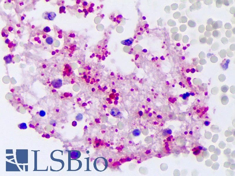 IHC-plus™ Polyclonal Rabbit anti-Human CXCL7 / PPBP Antibody (IHC, WB)