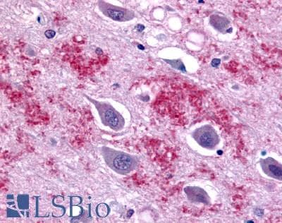 IHC-plus™ GALR1 / Galanin Receptor 1 Antibody (C-Terminus)