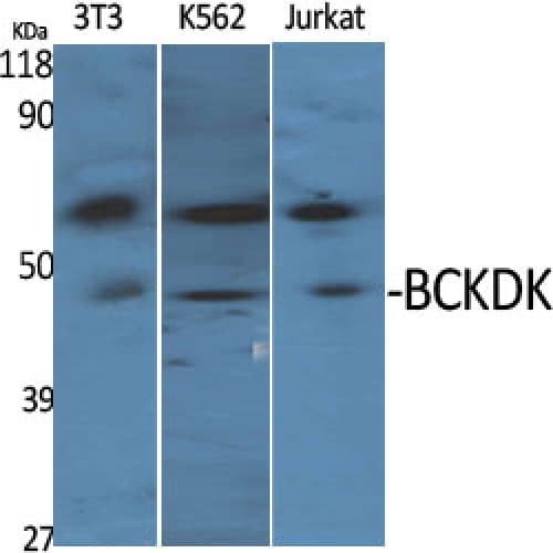 Polyclonal Rabbit anti-Human BCKDK Antibody (30-110 aa, N-terminal, IHC, IF, WB)