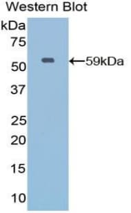 ER Alpha / Estrogen Receptor Antibody (aa248-484)