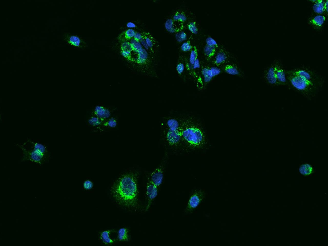Polyclonal Rabbit anti-Human SLC25A42 Antibody (IHC, IF)