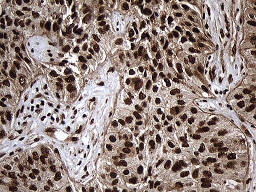 ASH2L / ASH2 Antibody (aa347-628, clone OTI2H3)