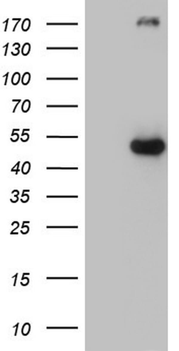 TP53 / p53 Antibody (clone OTI7D1)