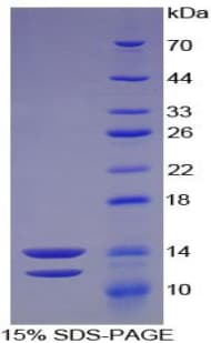 Human Peptide YY / PYY Protein (Recombinant His-T7)