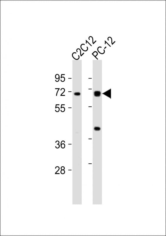 WASL / N-WASP Antibody (aa165-198)
