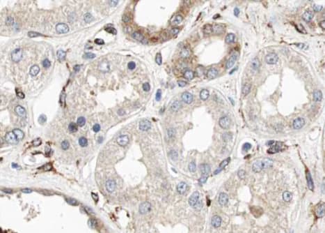 CUBN / Cubilin Antibody