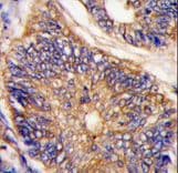 ARH / LDLRAP1 Antibody (aa11-42)