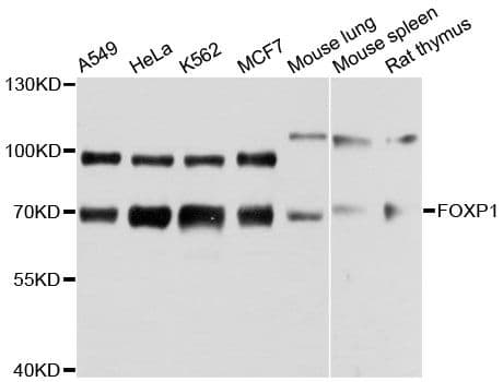 FOXP1 Antibody