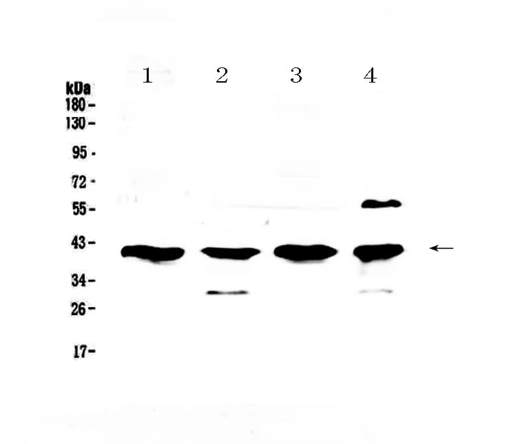 VEGFD Antibody (aa89-205)
