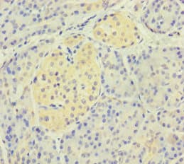 Polyclonal Rabbit anti-Human CD300LF / CD300f Antibody (aa20-156)