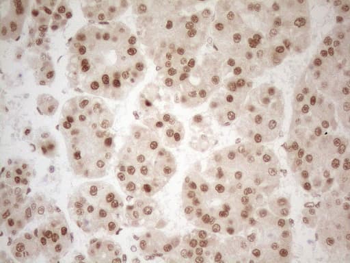 Monoclonal Mouse anti-Human RGL2 Antibody (clone OTI10F2, aa547-777, IHC, WB)