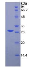 Human MMP2 Protein (Recombinant His, N-Terminal)