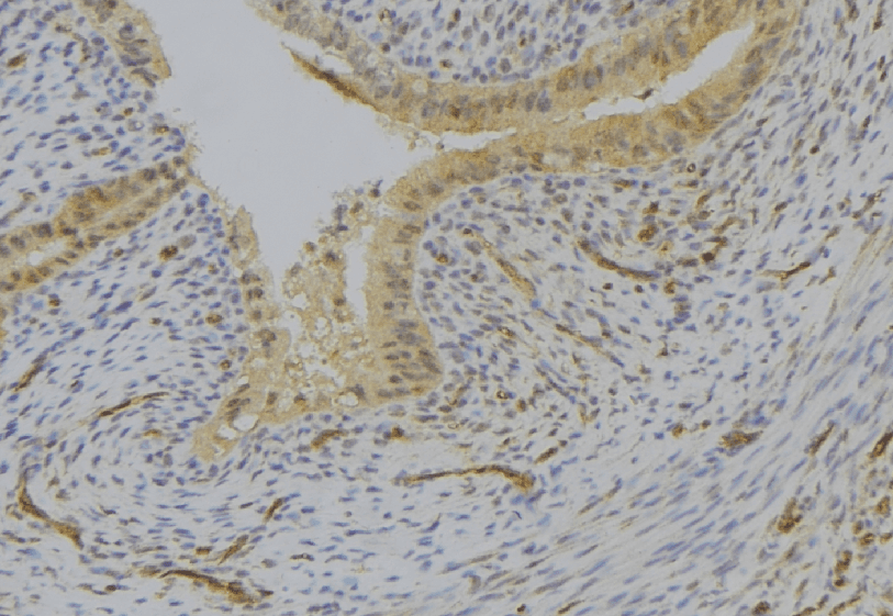 Polyclonal Rabbit anti-Human LY96 / MD2 / MD-2 Antibody (IHC, WB)