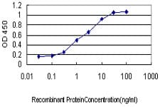 IHC-plus™ SSR1 Antibody (clone 1C11)