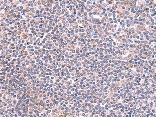 GMDS / GMD Antibody