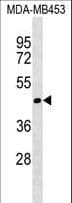 Polyclonal Rabbit anti-Human TIMM50 Antibody (aa74-104, WB)