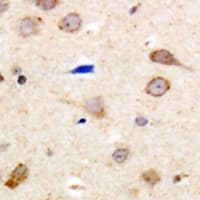 SIPR2 / S1P2 / EDG5 Antibody (C-Terminus)