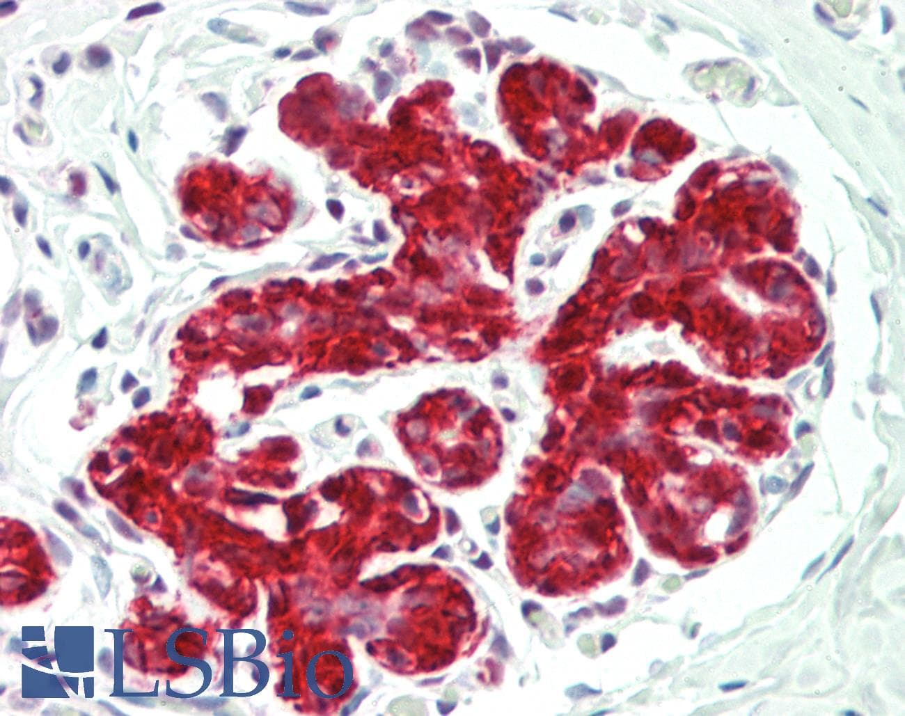 PathPlus™ Monoclonal Mouse anti-Human ENO1 / Alpha Enolase Antibody (clone 786CT6.6.4, IHC, WB)