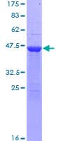 Human RAB1A Protein (Recombinant GST)