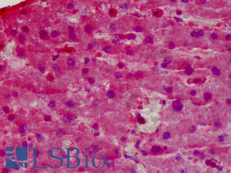 IHC-plus™ GPX1 / Glutathione Peroxidase Antibody