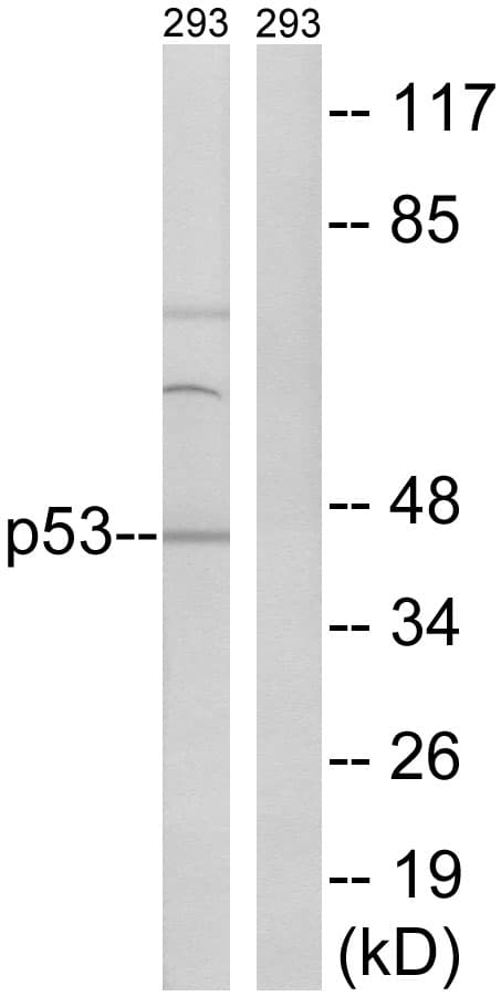 TP53 / p53 Antibody (aa341-390)