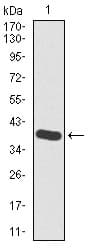 IHC-plus™ HAS2 Antibody (clone 4E7)