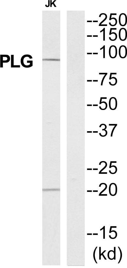 PLG / Plasmin / Plasminogen Antibody