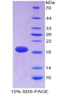 Rat SPTAN1 / Alpha Fodrin Protein (Recombinant His)