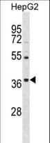 Polyclonal Rabbit anti-Human ORAI3 Antibody (aa1-30, WB)