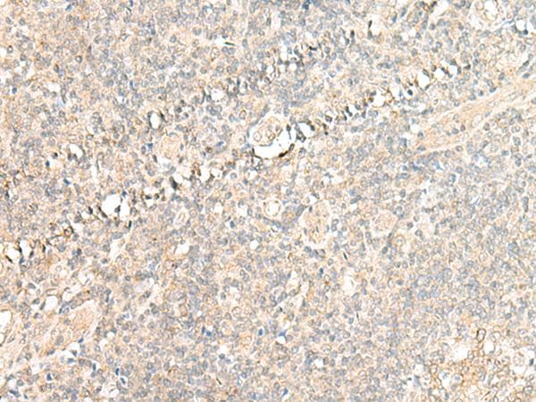 CALCOCO1 / CoCoa Antibody