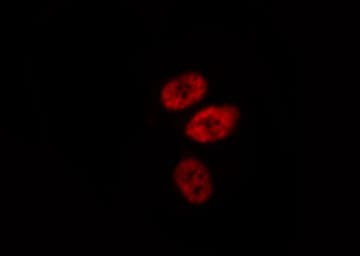 Polyclonal Rabbit anti-Human RB1 / Retinoblastoma / RB Antibody (IHC, IF, WB)