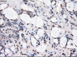 Monoclonal Mouse anti-Human BUB1B / BubR1 Antibody (clone OTI6E5, IHC, IF, WB)