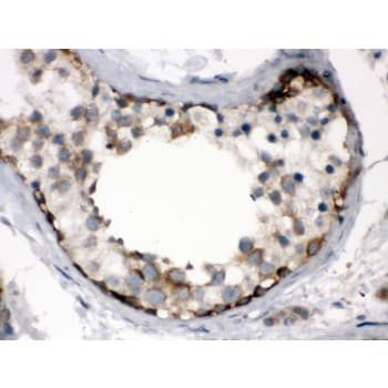 Polyclonal Rabbit anti-Human TCP1 Antibody (aa515-551, IHC, WB)