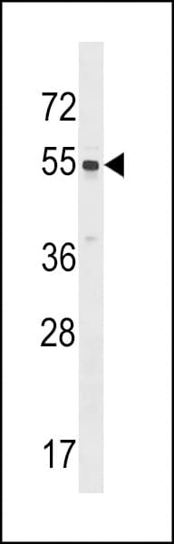 Polyclonal Rabbit anti-Human SRMS Antibody (aa456-485, IHC, WB)