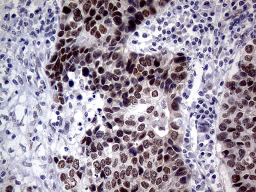 TLK2 Antibody (aa1-296, clone OTI2H2)