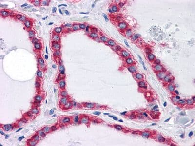 Monoclonal Mouse anti-Human HSPA5 / GRP78 / BiP Antibody (clone 4000, IHC, WB)