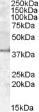 IHC-plus™ APOL6 / Apolipoprotein L 6 Antibody (aa16-27)