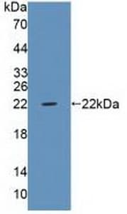 PTPRZ1 / Phosphacan Antibody (APC)