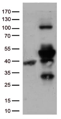 CD74 / CLIP Antibody (clone UMAB232, Carrier-free)