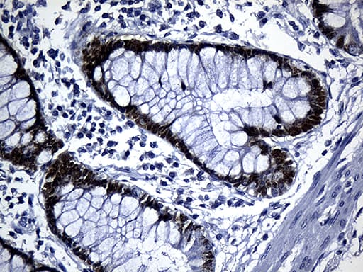 CDX1 Antibody (clone OTI2A5)