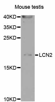 LCN2 / Lipocalin 2 / NGAL Antibody